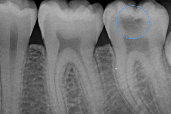 Studio Dentistico Gerboni - Radiografia